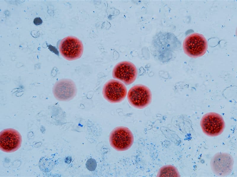 Test de enfermedad intestinal en Vilagarcía