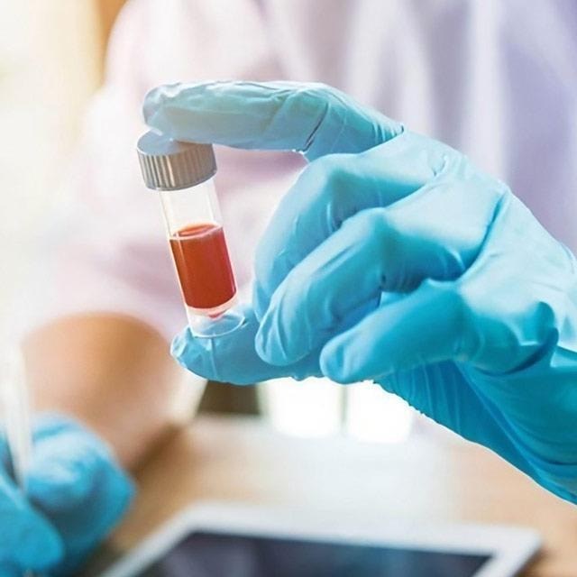 Laboratorio Pintor, expertos en análisis clínicos