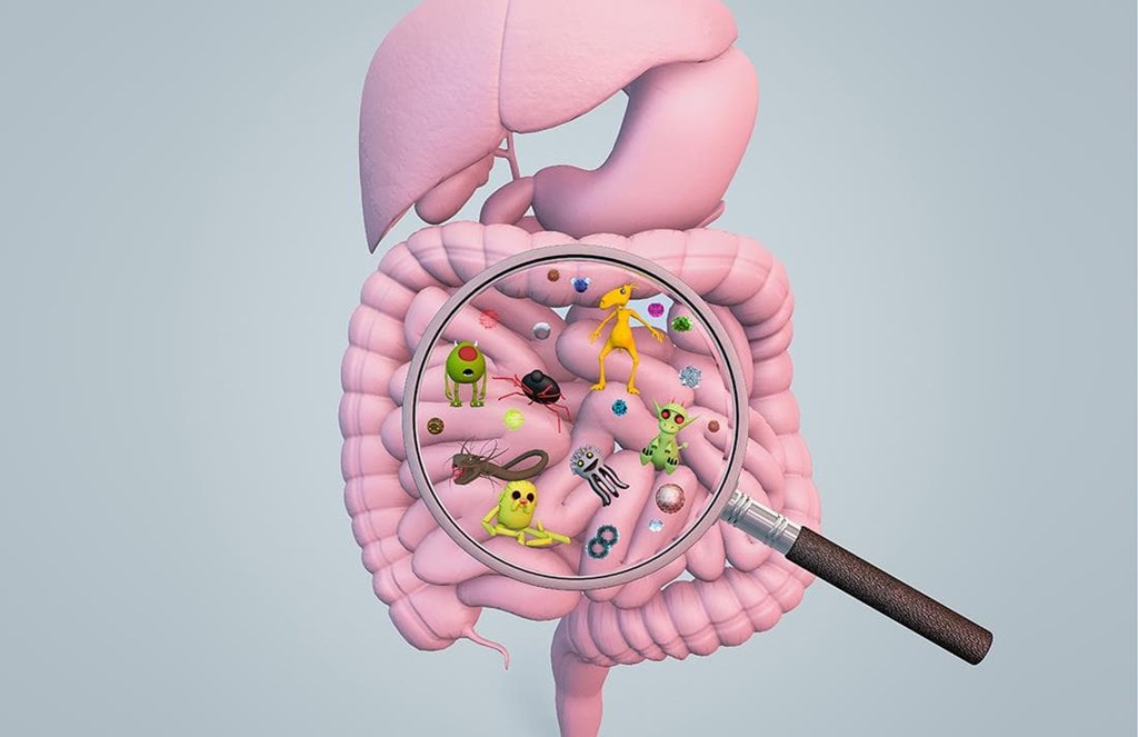 SINDROME DEL INTESTINO IRRITABLE (SII):  Sal de dudas con nuestra nueva prueba diagnóstica  en el Laboratorio Pintor.